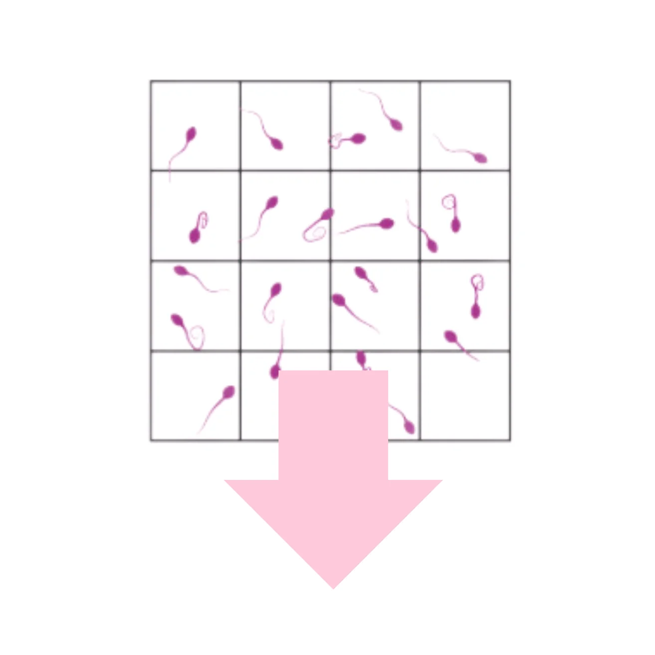 nekrozoospermia, spermiogram, nepohyblivé spermie